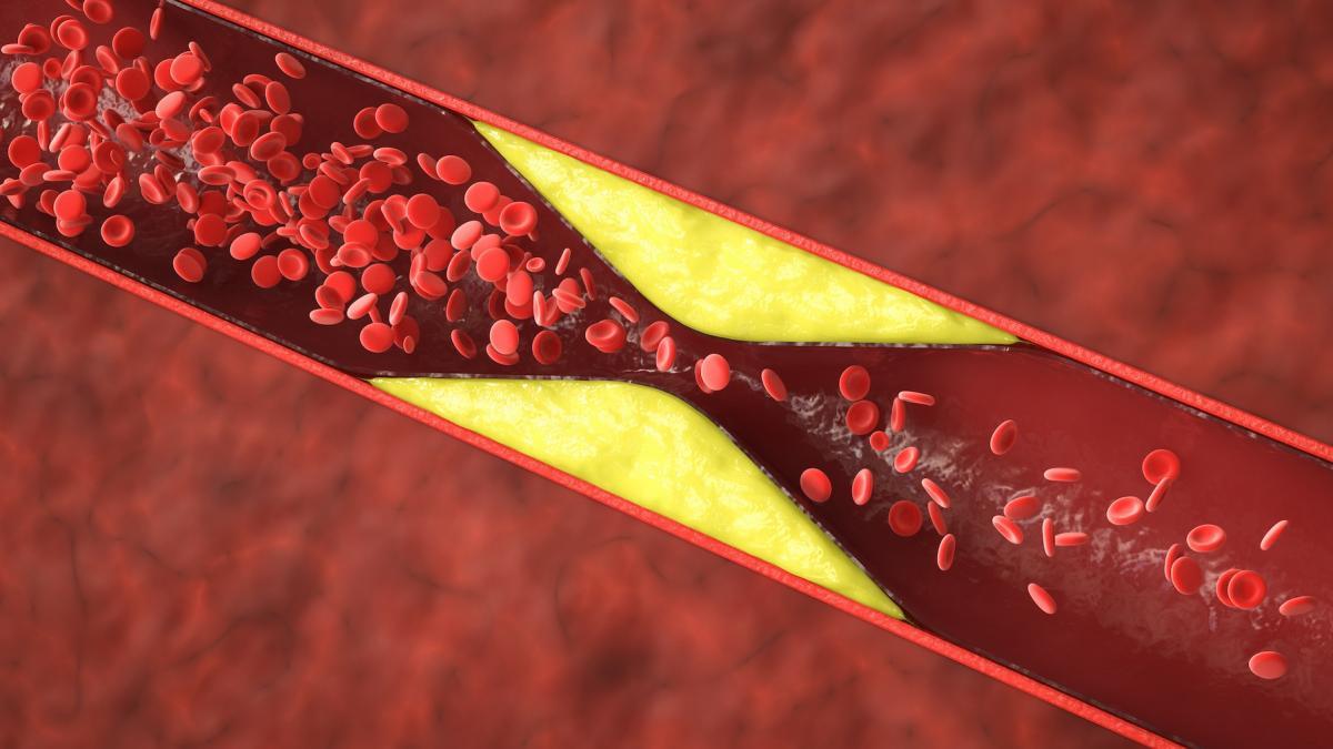 arterial.jpg
