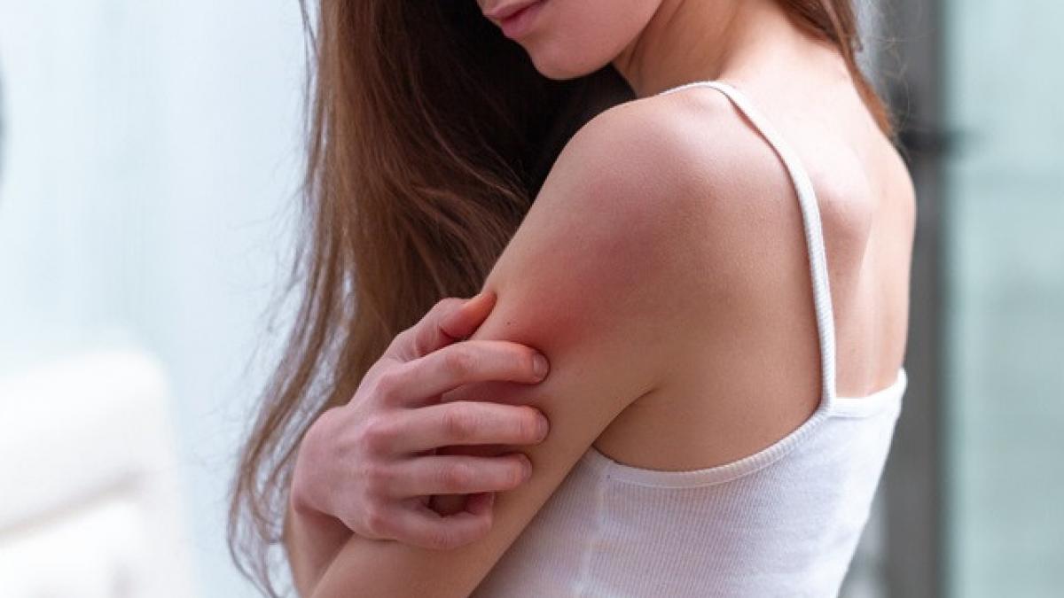 Terapii antipsoriazis la Ensana Sovata - 618805065_1358067929684557_750028514575344438_n