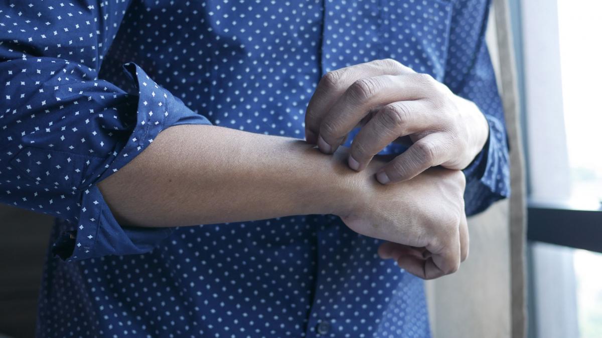 psoriazis