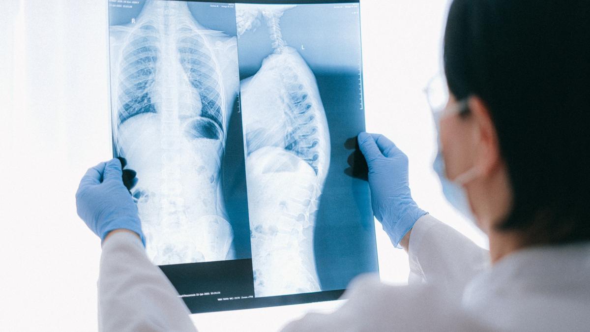 transplant pulmonar