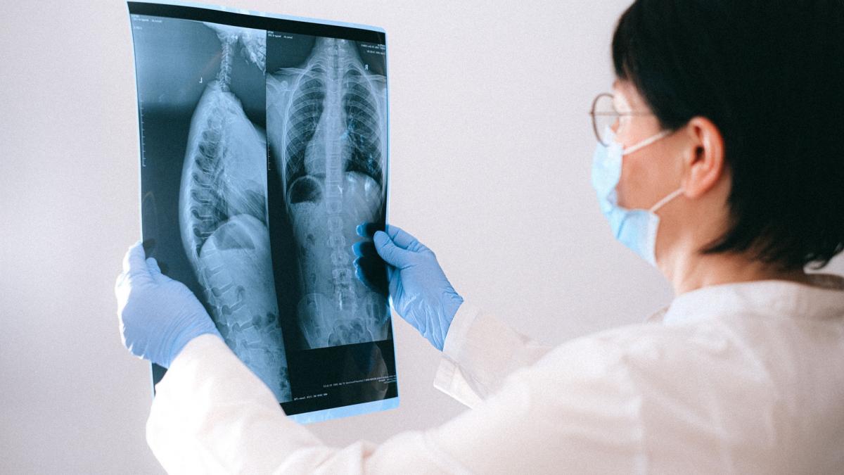 cancer esofagian