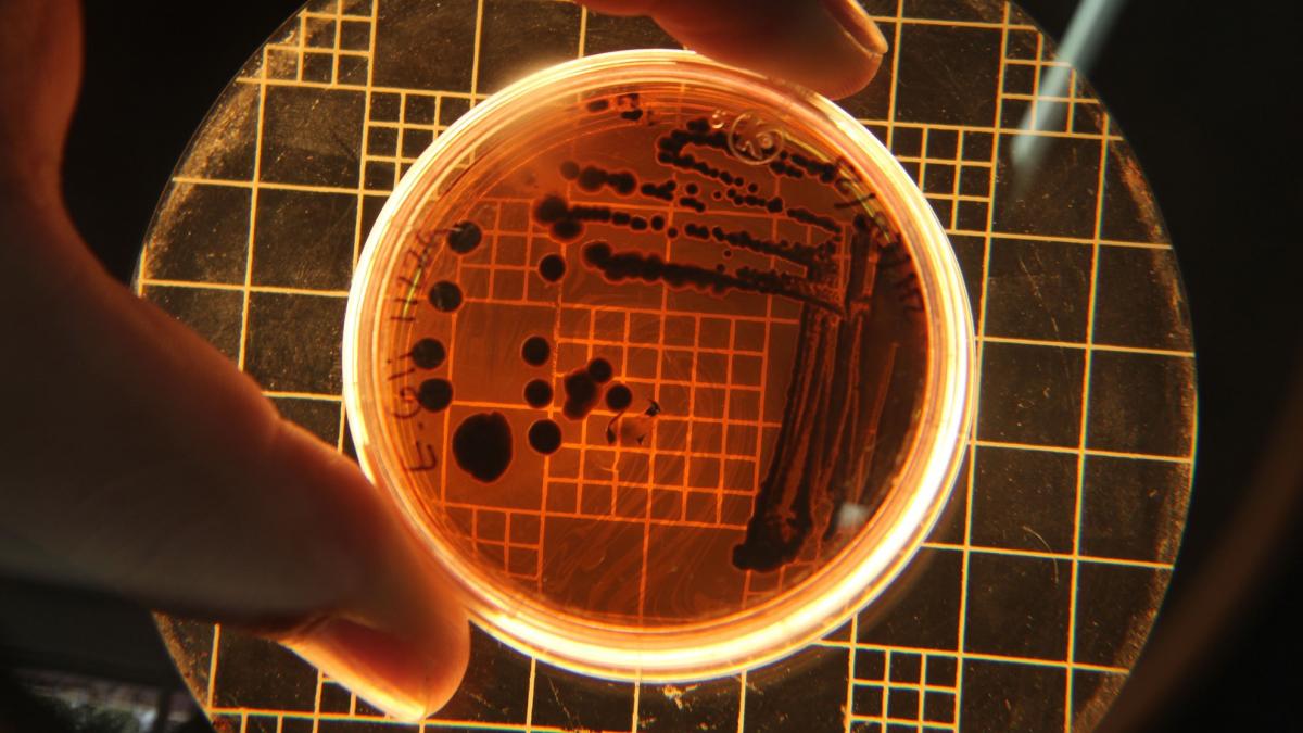 ciuma pneumpcocica