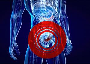 o bacterie provenita de la broaste distruge complet cancerul de colon