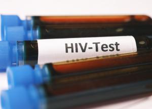 hiv in 2026 ce spun medicii despre speranta de viata