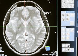 neuroplasticitatea dupa 40 creierul tau continua sa se schimbe