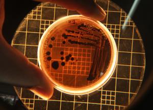 ciuma pulmonara boala rara care poate evolua rapid simptome transmitere si tratament