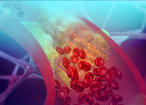 dieta care scade colesterolul alimente recomandate si cele de evitat