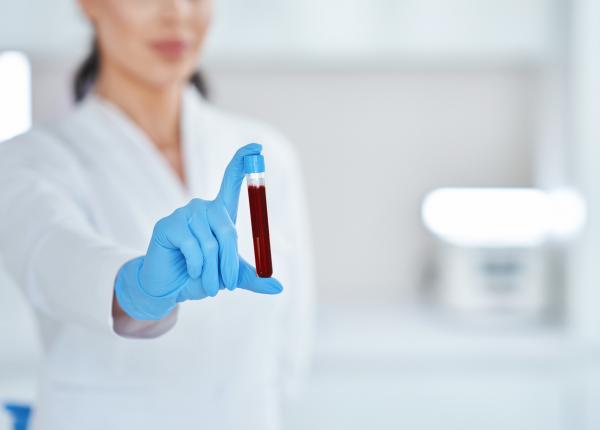 un simplu test de sange ar putea diagnostica boala alzheimer cu precizie