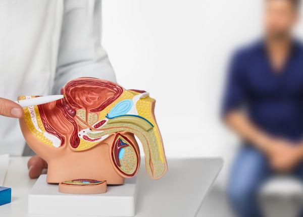 studiu cazurile de cancer de prostata se vor dubla pana in 2040