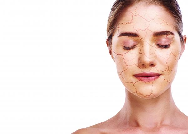 6 remedii naturiste impotriva acneei