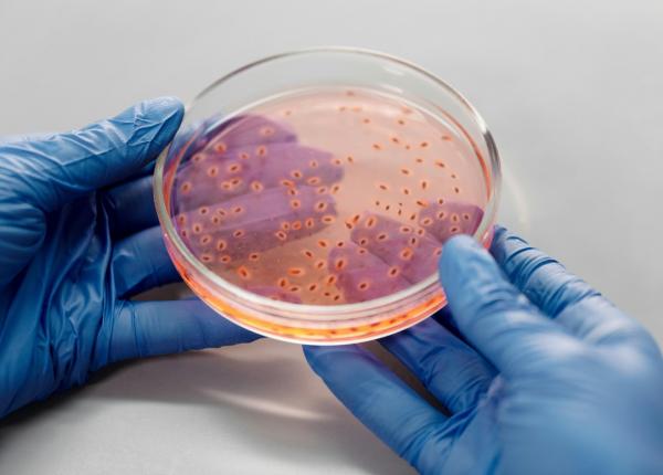 intestin sanatos minte fericita rolul intestinului in anxietate si stres