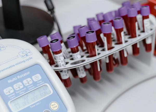 tratamentele inovatoare pot salva vietile a zeci de mii de pacienti insa romania ramane printre tarile cu cel mai lent acces la ele