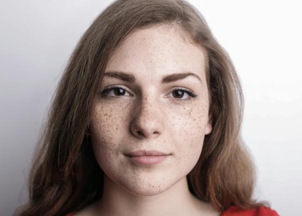 cum sa previi si sa tratezi petele pigmentare conform cercetarilor