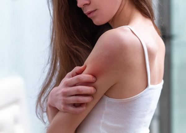 psoriazisul boala care incepe cu pielea si afecteaza intregul organism