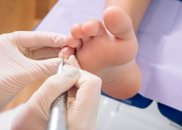 unghiile pot oferi indicii importante despre starea de sanatate semnele aparent banale care pot ascunde boli grave inclusiv cancer