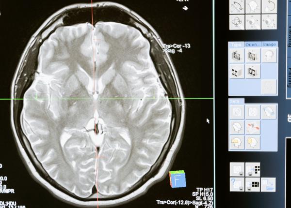 neuroplasticitatea dupa 40 creierul tau continua sa se schimbe