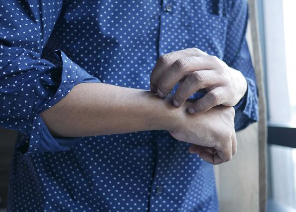 psoriazisul vara cum poti reduce puseele si iti poti calma pielea