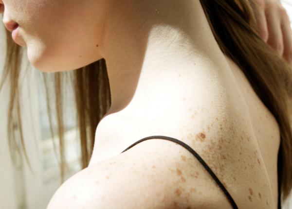 revolutie in oncologie vaccinul impotriva melanomului obtine un succes istoric