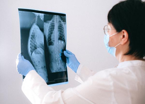 cauzele si factorii de risc ai cancerului esofagian