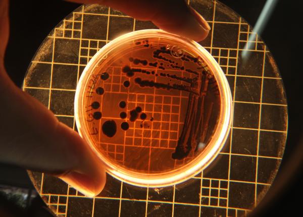 ciuma pulmonara boala rara care poate evolua rapid simptome transmitere si tratament