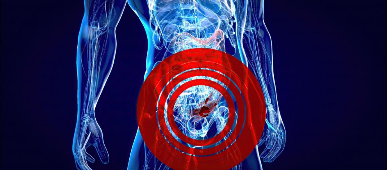 O bacterie provenită de la broaște distruge complet cancerul de colon