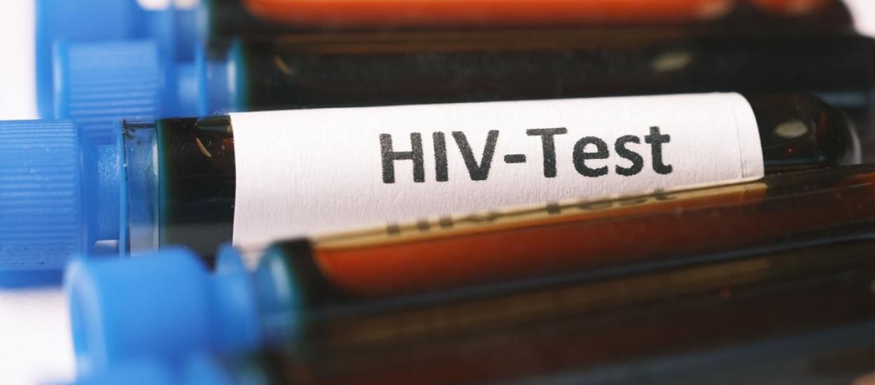 HIV în 2026: ce spun medicii despre speranța de viață