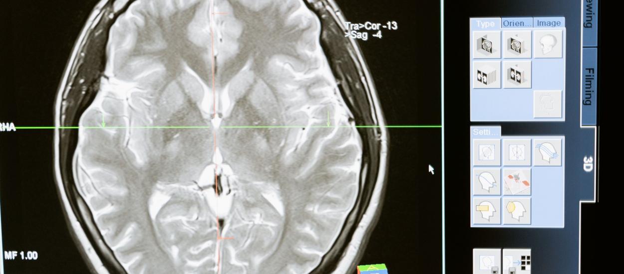 Neuroplasticitatea după 40: creierul tău continuă să se schimbe