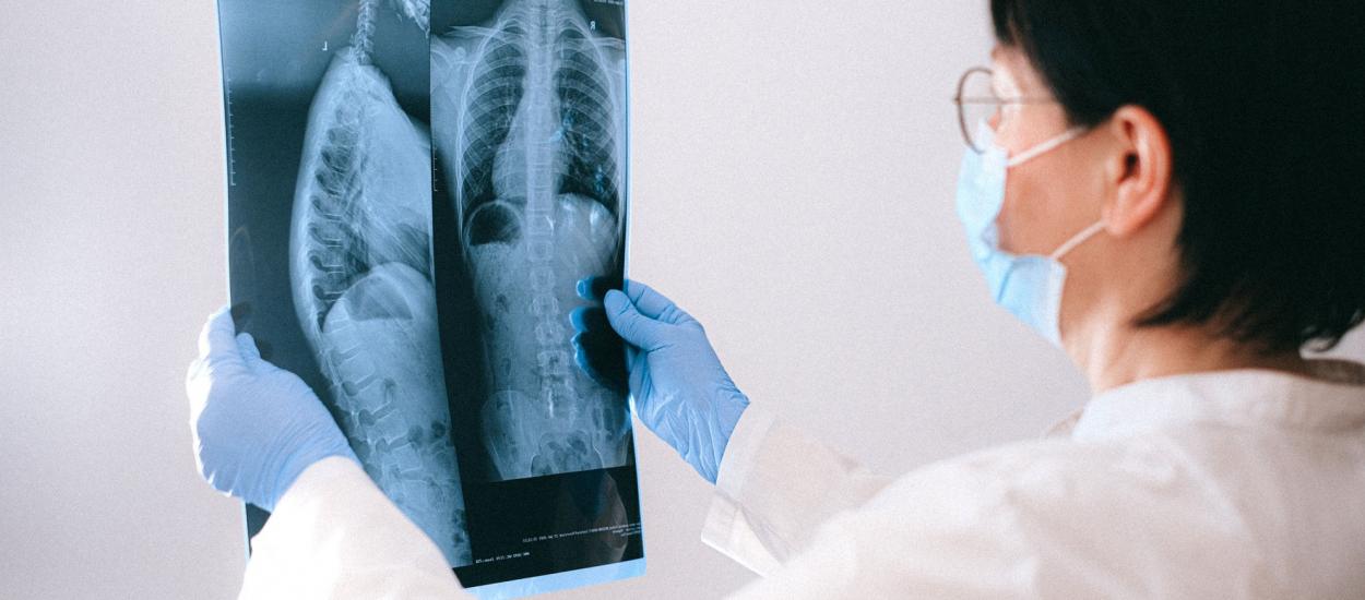 Cauzele și factorii de risc ai cancerului esofagian