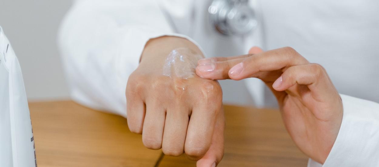 Legătura surprinzătoare dintre stres și puseele de eczemă