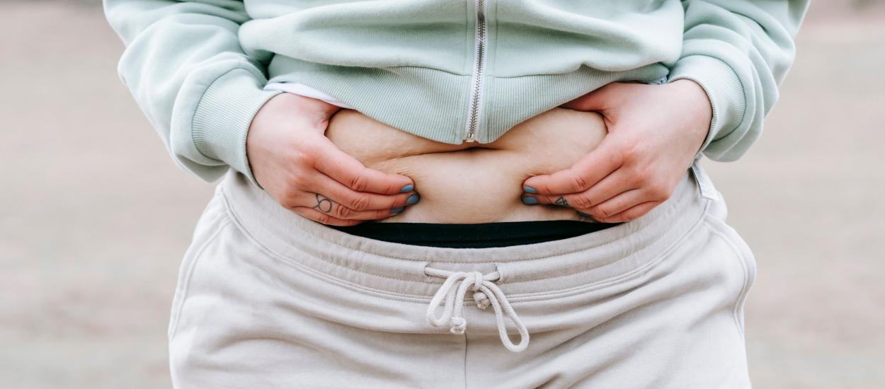 Grăsimea abdominală nu este doar o problemă estetică. Ce riscuri ascunde pentru sănătatea femeii