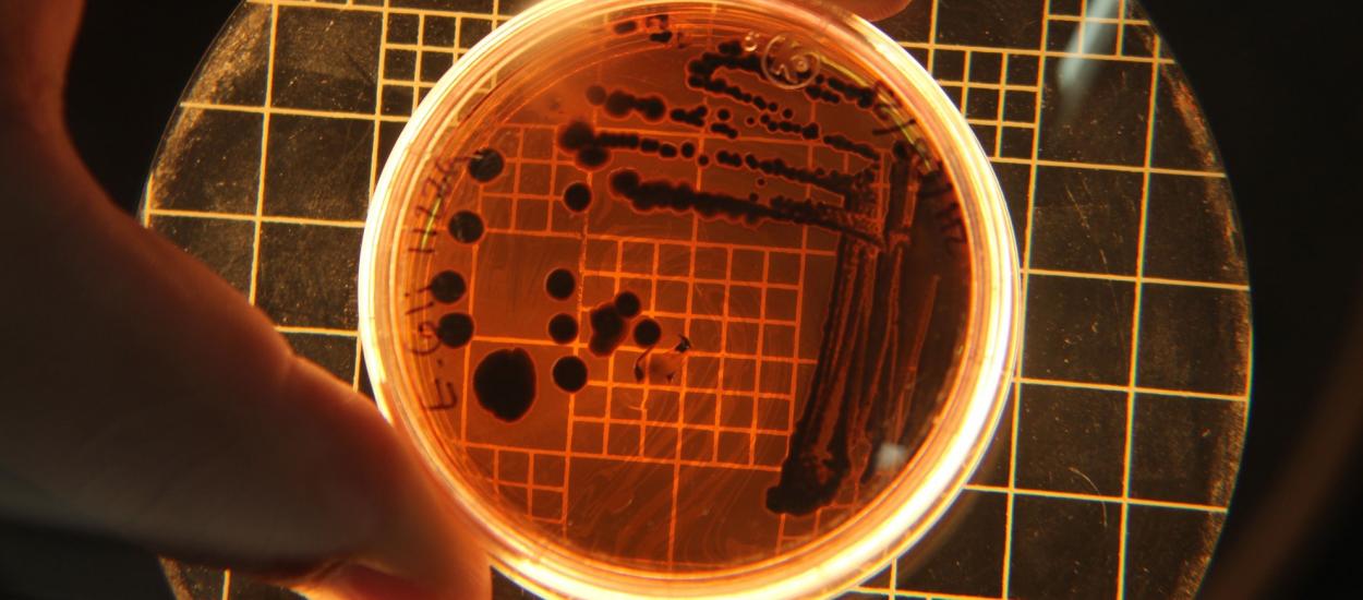 Ciuma pulmonară, boala rară care poate evolua rapid: simptome, transmitere și tratament